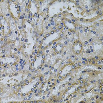 Anti-SERPINE2 Antibody (CAB5329)