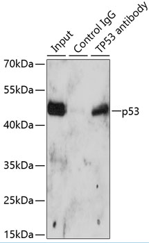 Anti-p53 Antibody [KO Validated] (CAB5761)