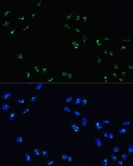 Anti-DDX21 Antibody (CAB14820)