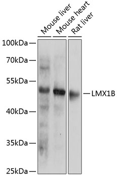 Anti-LMX1B Antibody (CAB14020)