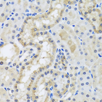 Anti-Centrin-3 Polyclonal Antibody (CAB8111)