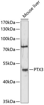 Anti-PTX3 Antibody (CAB12670)