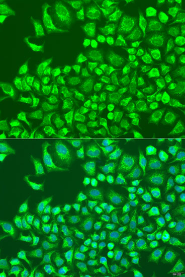 Anti-Cystatin-M Polyclonal Antibody (CAB8115)