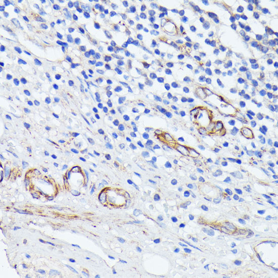 Anti-MADCAM1 Antibody (CAB3005)