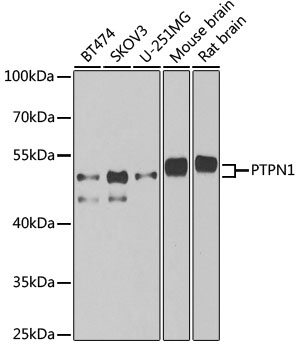 Anti-PTPN1 Antibody [KO Validated] (CAB1590)