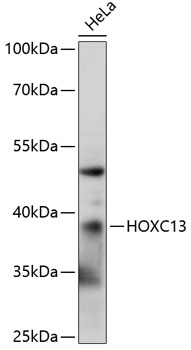 Anti-HOXC13 Antibody (CAB14998)