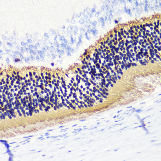 Anti-Phosducin Polyclonal Antibody (CAB8447)