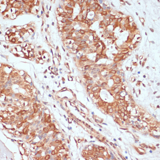 Anti-PTPRN2 Antibody (CAB14774)