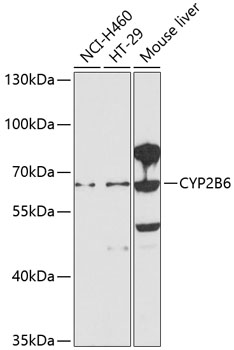 Anti-CYP2B6 Antibody (CAB1463)