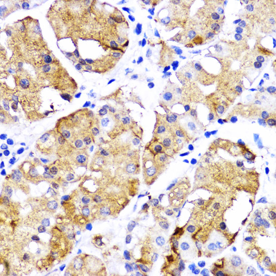 Anti-BMPR1B Antibody (CAB2005)