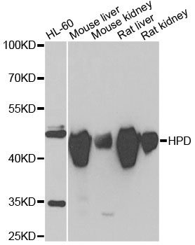 Anti-HPD Antibody (CAB6505)