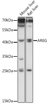 Anti-AREG Antibody (CAB12680)