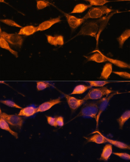 Anti-RAB11A Antibody (CAB17031)