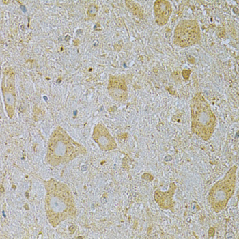 Anti-CAMK1G Antibody (CAB7379)