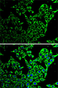 Anti-Hsp60 Antibody (CAB0969)