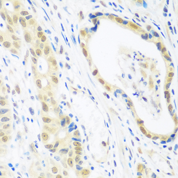 Anti-POLR2E Antibody (CAB1755)