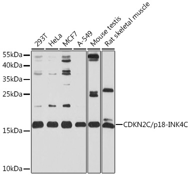 Anti-CDKN2C/p18-INK4C Antibody (CAB2042)