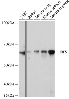 Anti-IRF5 Antibody