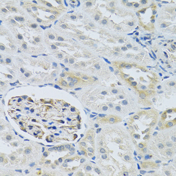 Anti-SLC29A1 Antibody (CAB13204)