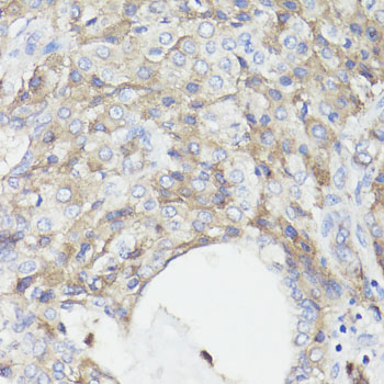 Anti-CD59 Antibody (CAB1689)