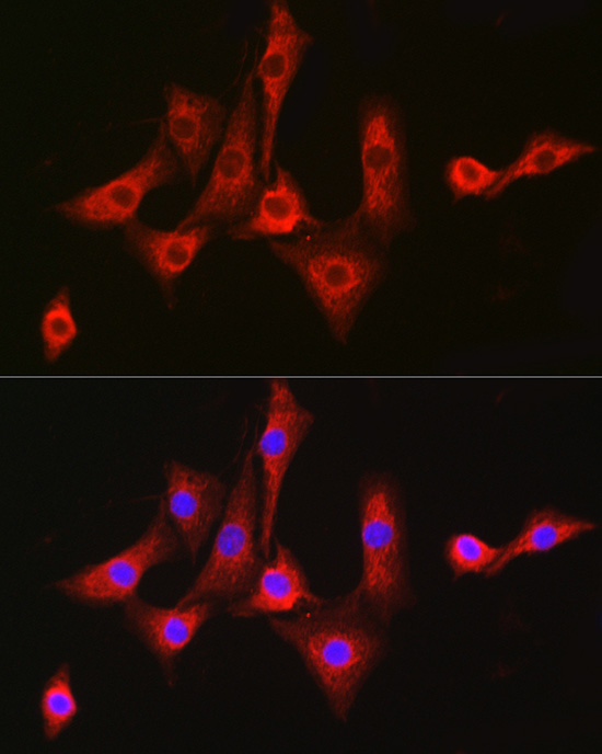 Anti-ACSL4 Antibody (CAB6826)