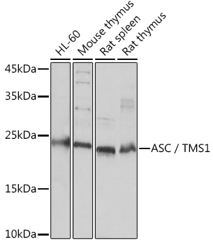 Anti-ASC / TMS1 Antibody (CAB16672)