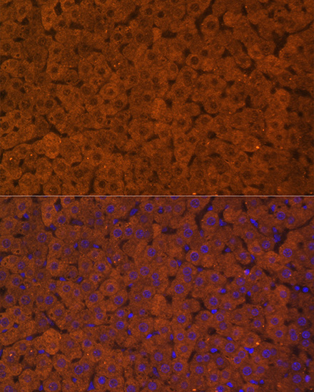 Anti-UGT1A1 Antibody (CAB6186)