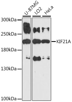 Anti-KIF21A Antibody (CAB16548)