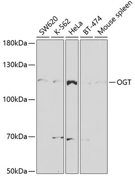 Anti-OGT Antibody (CAB2214)