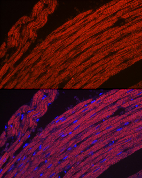 Anti-MYH1 Antibody (CAB6935)