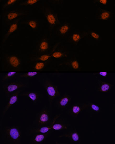 Anti-SRSF7 Antibody (CAB16738)