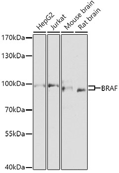 Anti-BRAF Antibody (CAB0038)