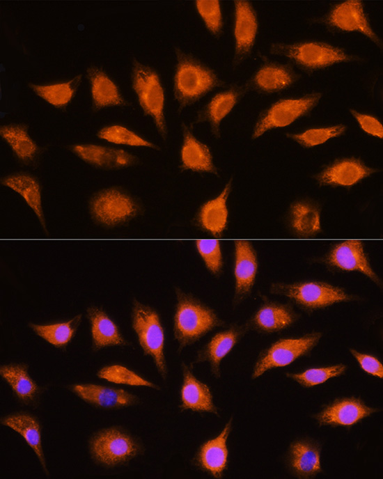 Anti-GNAI3 Antibody [KO Validated] (CAB13307)