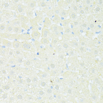 Anti-TRIM15 Antibody (CAB11730)