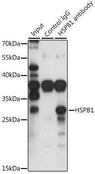 Anti-HSPB1 Antibody (CAB0240)