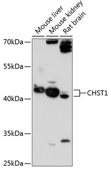 Anti-CHST1 Antibody (CAB13057)