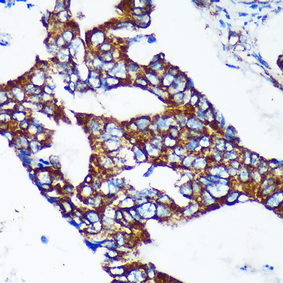 Anti-EPN2 Antibody (CAB16106)