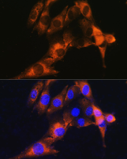 Anti-ANPEP Antibody (CAB5662)