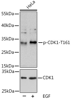 Anti-Phospho-CDK1-T161 Antibody (CABP0324)