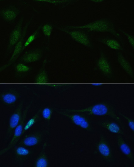 Anti-LIG4 Antibody (CAB1743)