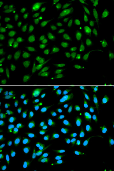 Anti-ING3 Antibody (CAB5832)