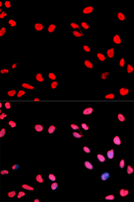 Anti-Phospho-CCNE1-T395 Antibody (CABP0013)