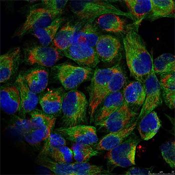 Anti-Phospho-NFKB2-S866 Antibody (CABP0418)