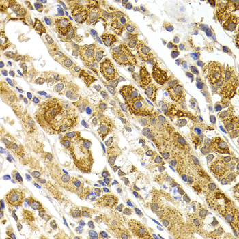 Anti-BMP15 Antibody (CAB7321)