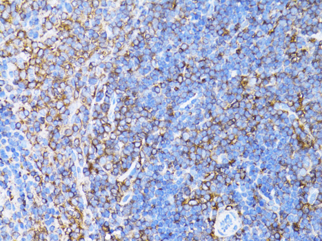 Anti-Beta Actin Mouse Monoclonal Antibody (CABC004)