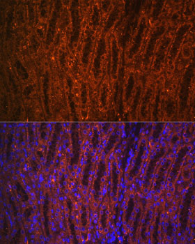 Anti-PCK1 Antibody (CAB2036)