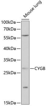 Anti-CYGB Antibody (CAB14155)