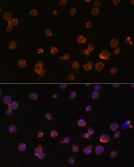 Anti-CTGF Antibody (CAB11067)