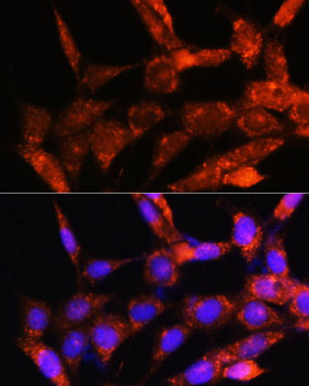 Anti-COX6C Antibody (CAB16250)