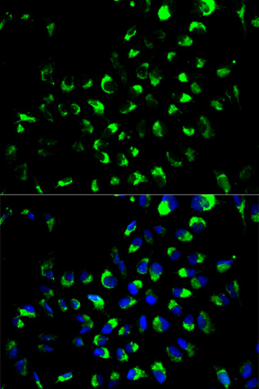 Anti-AK4 Antibody (CAB13461)